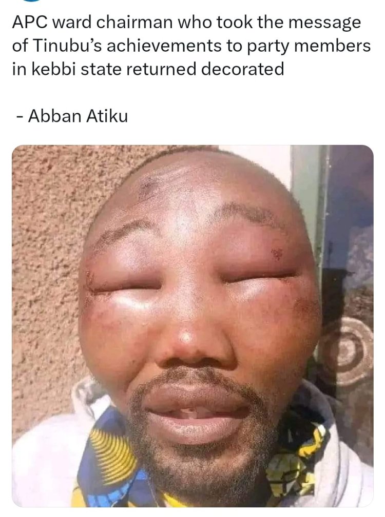 APC ward chairman who took the message of Tinubu’s achievements to party members in kebbi state returned with wounds